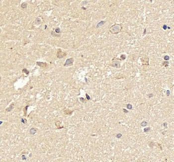 IHC staining of FFPE human brain tissue with Neurogenin 1 antibody, HRP-secondary and DAB substrate.