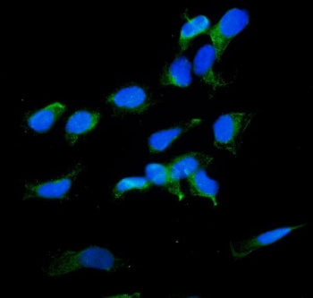 IF/ICC staining of FFPE human HeLa cells with Radixin antibody (green) at 2ug/ml and DAPI nuclear st