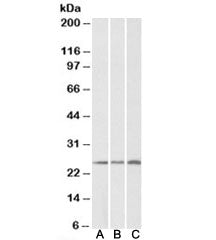 Western blot testing of human [A], mouse [B] and rat [C] kidney lysates with CSRP2 antibody at 0.2ug
