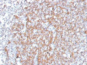 Cystatin A Antibody / CSTA