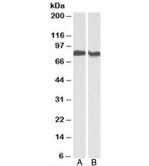 Western blot testing of human placenta [A] and rat brain [B] lysates with PRKCB antibody at 0.3ug/ml