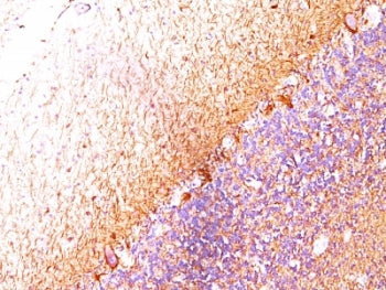 IHC: Formalin-fixed, paraffin-embedded human cerebellum stained with Neurofilament antibody (RT-97 +