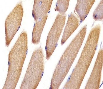 IHC testing of FFPE mouse skeletal muscle tissue with Vinculin antibody. HIER: steam section in pH6 