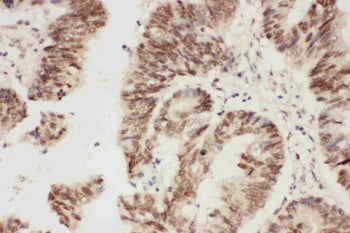 ALK Antibody