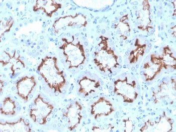 IHC staining of FFPE human kidney with recombinant Interferon gamma antibody. HIER: boil tissue sect