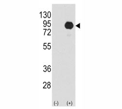 Western blot analysis of BRAF antibody and 293 cell lysate (2 ug/lane) either nontransfected (Lane 1