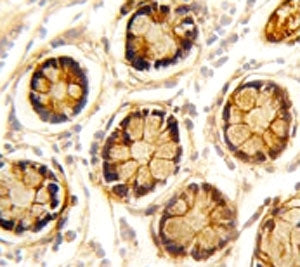 PDGFRL Antibody