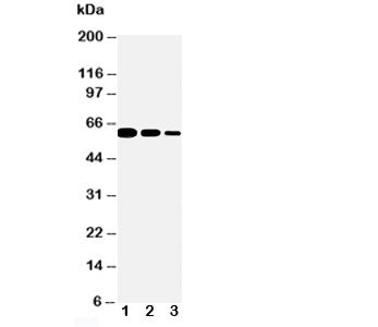 Western blot testing of CD40 antibody and Lane 1: Recombinant mouse protein 10ng; 2: 5ng; 3: 2.5ng