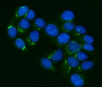 Immunofluorescent staining of FFPE human MCF7 cells with ABCB1 antibody (green) and DAPI nuclear sta