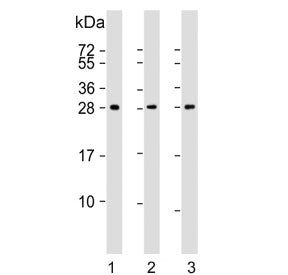 Western blot testing of human 1) A431, 2) skeletal muscle and 3) brain lysate with Density Regulated