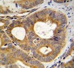 TRPM8 antibody immunohsitochemistry analysis in formalin fixed and paraffin embedded human prostate 