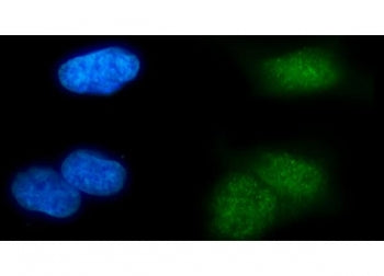Immunofluorescent staining of FFPE human U-2 OS cells with MSL2 antibody (green) and DAPI nuclear st
