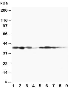 Western blot testing of MEK3 antibody and Lane 1: rat spleen; 2: rat thymus; 3: rat skeletal muscle;
