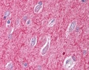 IHC testing of FFPE human cerebral cortex with ICAM5 antibody at 2.5ug/ml. HIER: steamed with pH6 ci