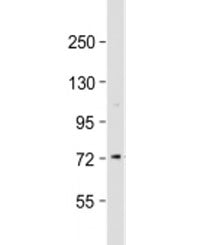 Western blot testing of human Jurkat cell lysate with CTCFL antibody at 1:2000. Predicted molecular 