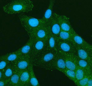 Immunofluorescent staining of TNS3 using anti-TNS3 antibody. TNS3 was detected in an immunocytochemi
