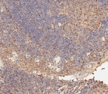 IHC testing of FFPE human tonsil tissue with CD276 antibody. HIER: steam section in pH9 EDTA for 20 