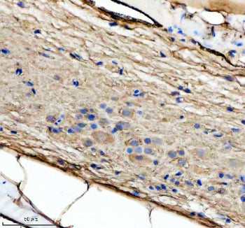 IHC staining of zebrafish Bdnf protein using Zebrafish Bdnf antibody, HRP-labeled secondary and DAB 