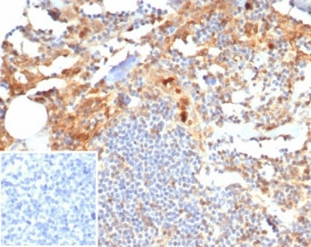 S100P Antibody / MIG9
