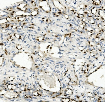 IHC staining of FFPE human appendicitis tissue with NOVA2 antibody. HIER: boil tissue sections in pH