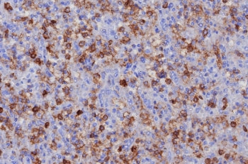 IHC staining of FFPE human spleen tissue with PSGL-1 antibody (clone PSGL1/8192R). HIER: boil tissue