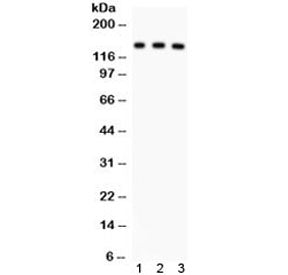 ABCB11 Antibody