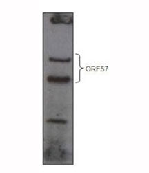 HHV8 ORF57 antibody western blot analysis of over-expressed GFP-tagged ORF57 in HEK293T cell line.