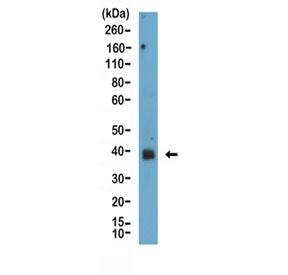 Western blot testing of human prostate tissue lysate with Podoplanin antibody at 1:100. Predicted mo