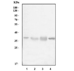 Cathepsin L Antibody / CTSL
