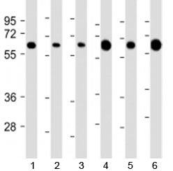 Western blot testing of 1) human HeLa, 2) human Jurkat, 3) human HepG2, 4) human liver, 5) mouse bra