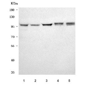NARG1 Antibody / NAA15