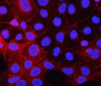 PDGFR alpha Antibody / PDGFRA / PDGFR2