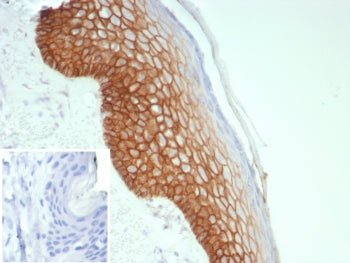 Desmoglein 3 Antibody / DSG3
