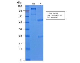 SDS-PAGE analysis of purified, BSA-free recombinant Cytokeratin 8 antibody (clone KRT8/2174R) as con
