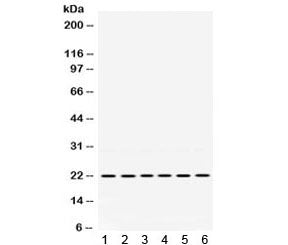 BIK Antibody / BCL2-interacting killer