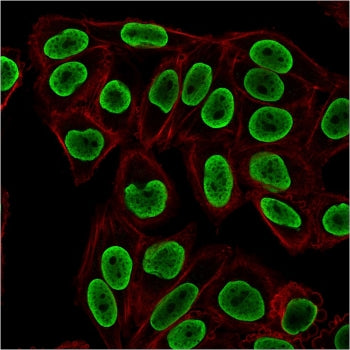 Immunofluorescent staining of PFA-fixed human HeLa cells with recombinant Histone H1 antibody (clone