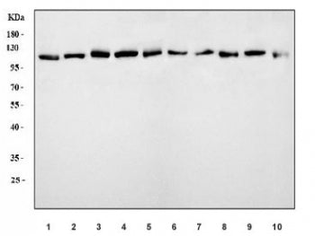 ERK5 Antibody / MAPK7