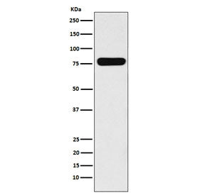 Western blot testing of human Caco-2 cell lysate with VIL1 antibody. Predicted molecular weight ~93 