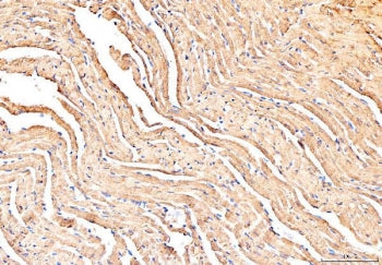 Phospholamban Antibody / PLN / PLB