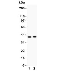 NDRG2 Antibody