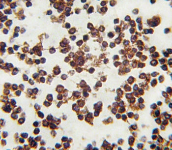 IHC testing of FFPE human lymph tissue with ALOX15 antibody. HIER: steam section in pH6 citrate buff