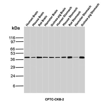 Western blot analysis of Human Brain, Mouse Brain, Rat Brain, Hamster Brain, Guinea pig Brain, Human