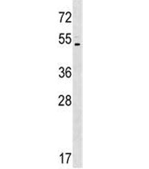 Western blot testing of human K562 lysate with ASIC5 antibody at 1:500. Predicted molecular weight ~