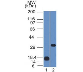 Western blot testing of 1) partial recombinant protein and 2) human Raji cell lysate with CD79b anti