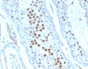 KIF2C Antibody / MCAK