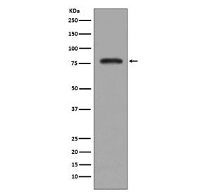 Western blot testing of human K562 cell lysate with PKC beta 2 antibody. Predicted molecular weight 