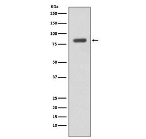 Western blot testing of human Daudi cell lysate with IKK beta antibody. Predicted molecular weight ~