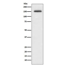 Western blot testing of human Jurkat cell lysate with ITGA4 antibody. Predicted molecular weight ~11