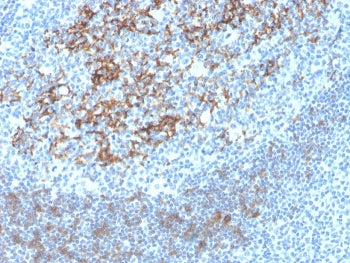 IHC staining of FFPE human tonsil with recombinant CD23 antibody (clone FCER2/4395R). HIER: boil tis