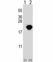 PIN1 Antibody